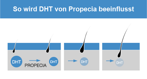 Propecia deutschland kaufen