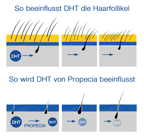 Propecia ergebnisse